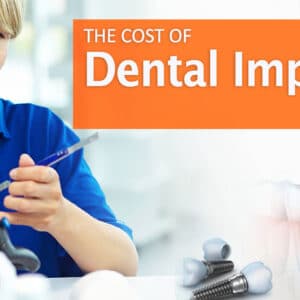 Cost of Dental Implants in Canada