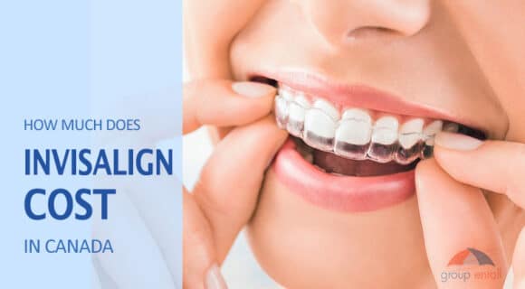 How Much Does Invisalign Cost in Canada?