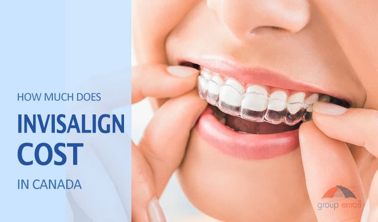 how much does invisalign cost in canada by groupenroll watermark lowres
