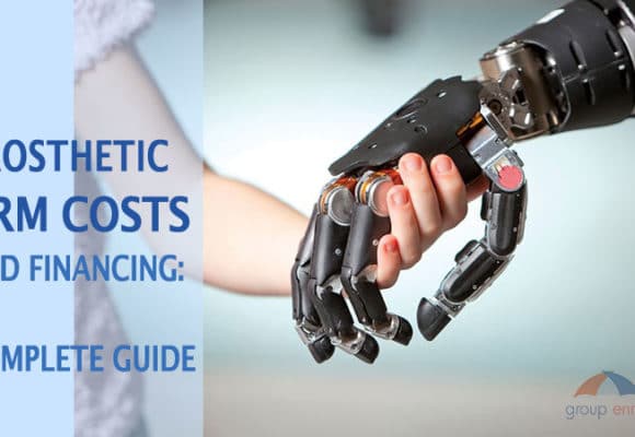 Prosthetic Arm Costs and Financing: A Comprehensive Guide